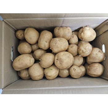 유벨안과 감자후원 이미지